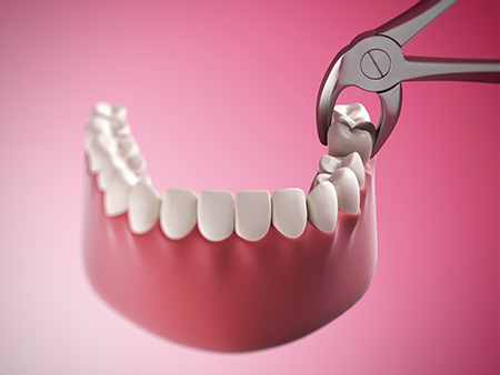 Maple Dental | Implant Dentistry, Dentures and Periodontal Treatment