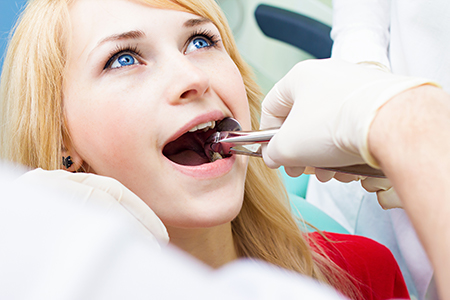 tooth extractions