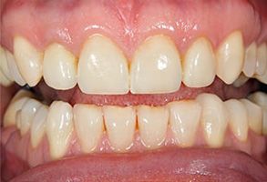 Maple Dental | Dental Fillings, Pediatric Dentistry and Dental Bridges