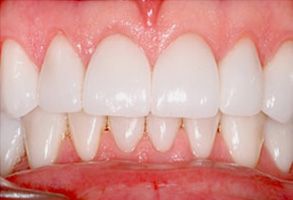 Maple Dental | Invisalign®, Teeth Whitening and Sedation Dentistry