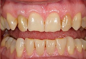 Maple Dental | Dental Cleanings, Digital Radiography and Veneers