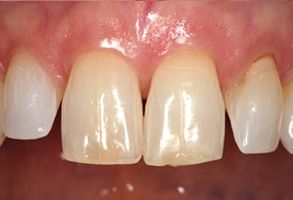 Maple Dental | Pediatric Dentistry, Oral Cancer Screening and Oral Exams
